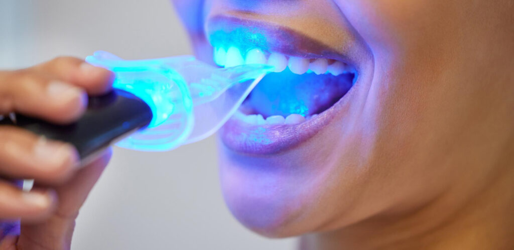 Teeth Whitening