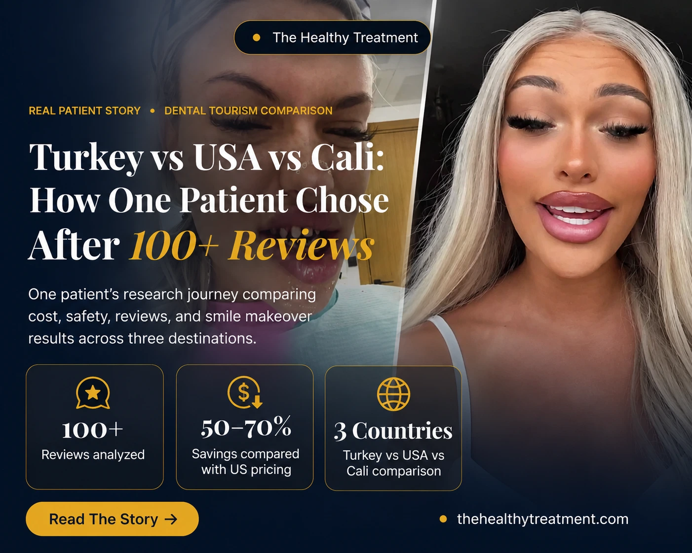 Veneers Colombia vs Turkey vs USA cost and verification comparison for international patients