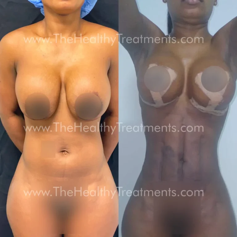 THT-BODY-PHOTO-01-1024x1024