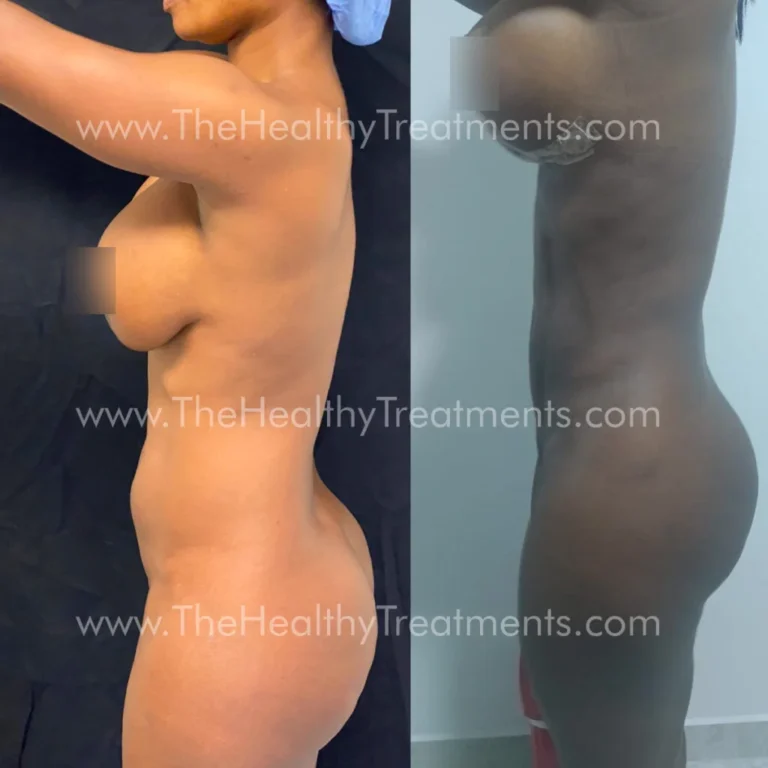 THT-BODY-PHOTO-02-1024x1024