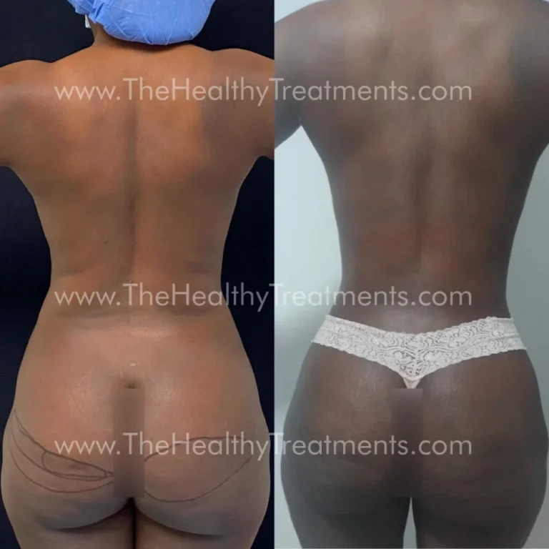 THT-BODY-PHOTO-03-1024x1024