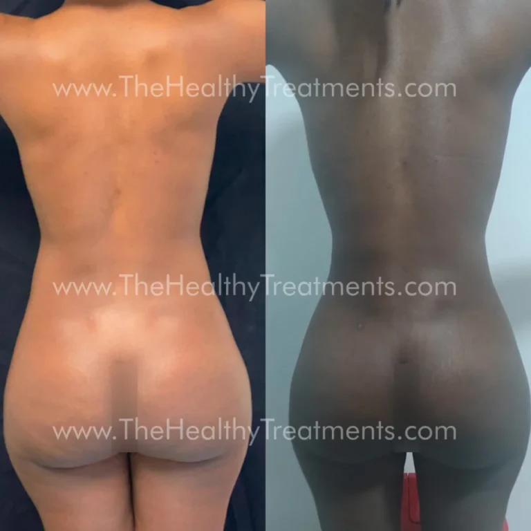 THT-BODY-PHOTO-04-1024x1024
