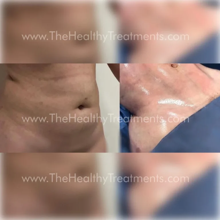 THT-BODY-PHOTO-05-1024x1024