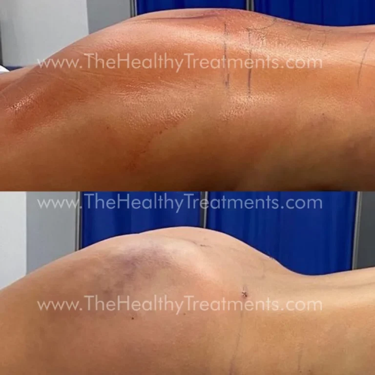 THT-BODY-PHOTO-07-1024x1024