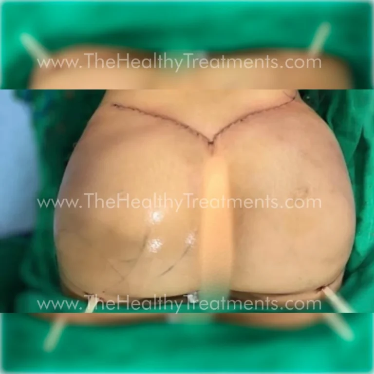 THT-BODY-PHOTO-08-1024x1024