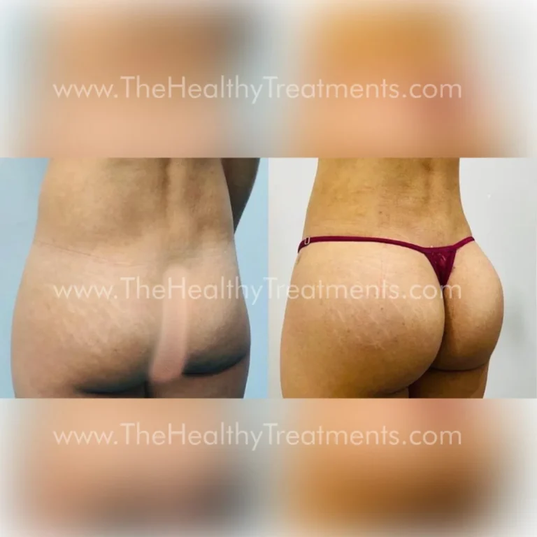 THT-BODY-PHOTO-09-1024x1024