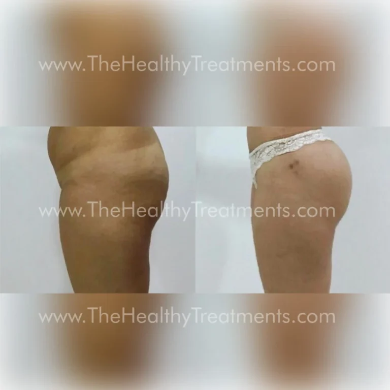 THT-BODY-PHOTO-10-1024x1024