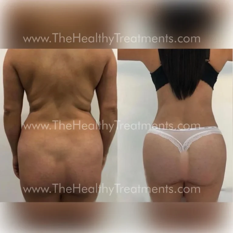 THT-BODY-PHOTO-11-1024x1024