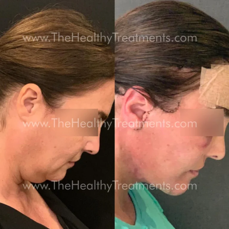 THT-FACE-PHOTO-02-1024x1024