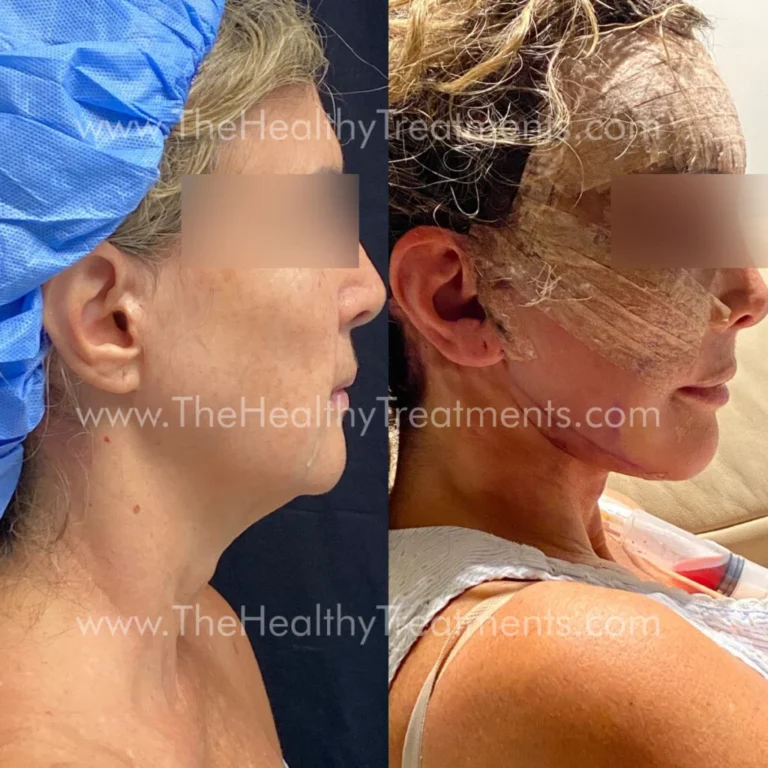 THT-FACE-PHOTO-03-1024x1024