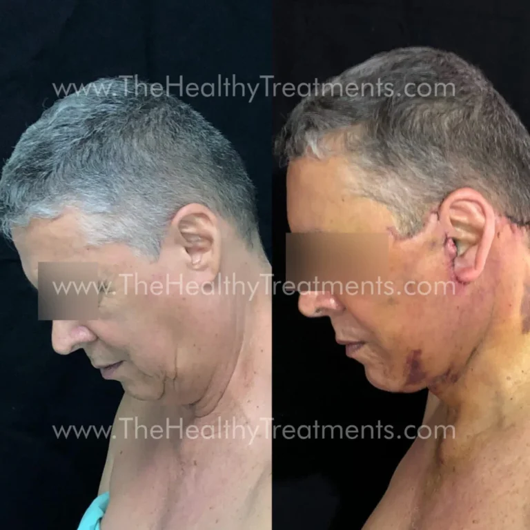 THT-FACE-PHOTO-04-1024x1024