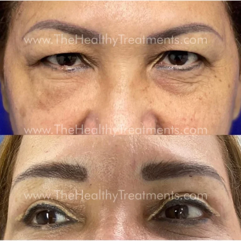 THT-FACE-PHOTO-05-1024x1024