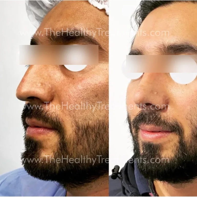 THT-FACE-PHOTO-06-1024x1024