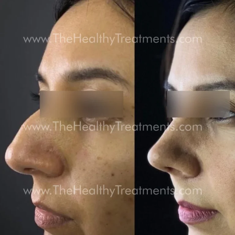 THT-FACE-PHOTO-08-1024x1024