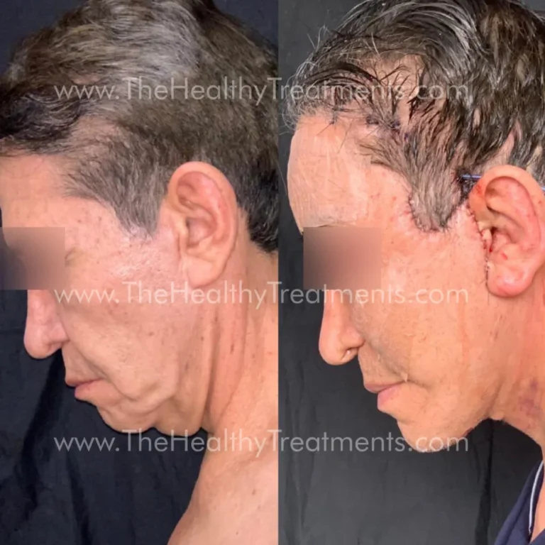 THT-FACE-PHOTO-09-1024x1024