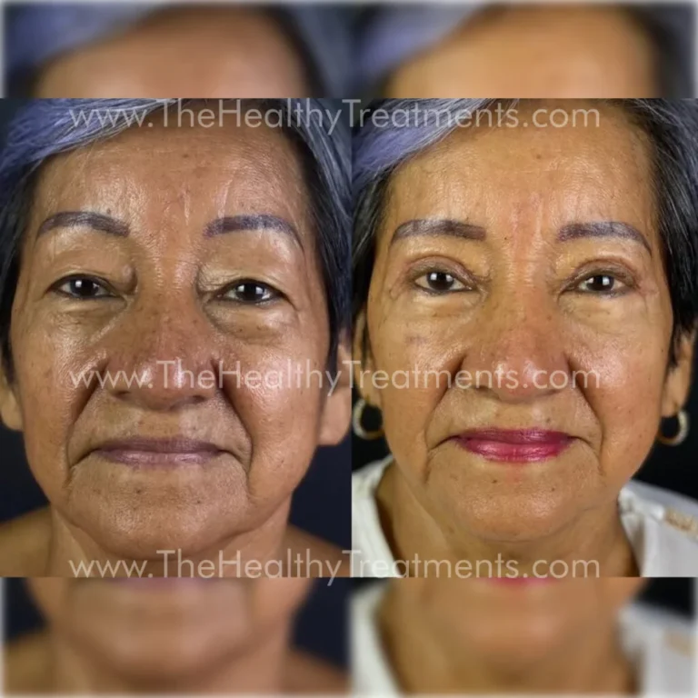 THT-FACE-PHOTO-10-1024x1024