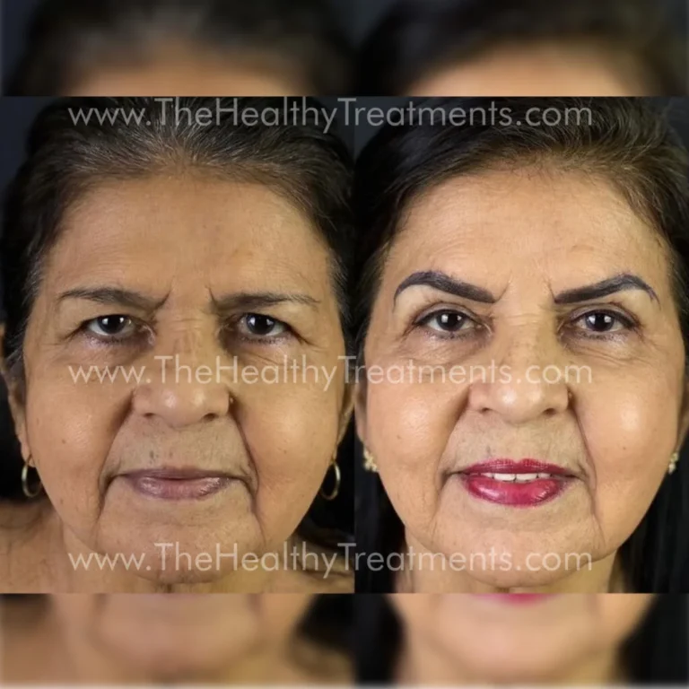 THT-FACE-PHOTO-11-1024x1024