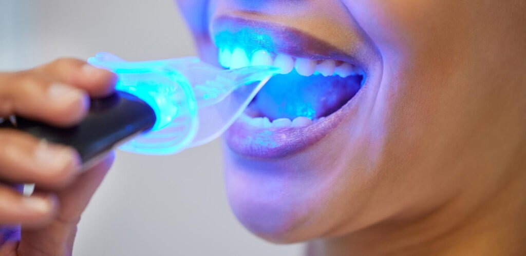 Teeth Whitening